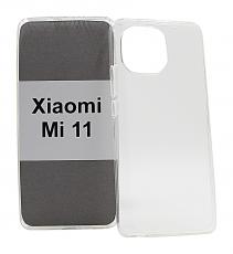 billigamobilskydd.seTPU Case Xiaomi Mi 11