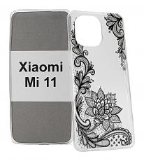 billigamobilskydd.seDesign Case TPU Xiaomi Mi 11