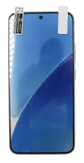 billigamobilskydd.seScreen Protector Xiaomi 15
