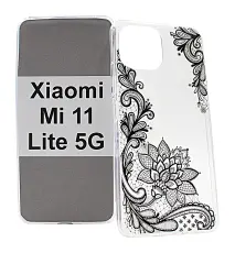 billigamobilskydd.seDesign Case TPU Xiaomi Mi 11 Lite / Mi 11 Lite 5G