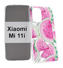 billigamobilskydd.seDesign Case TPU Xiaomi Mi 11i