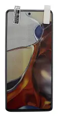 billigamobilskydd.seScreen Protector Xiaomi 11T / 11T Pro