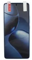 billigamobilskydd.seScreen Protector Xiaomi 14T Pro