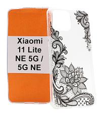 billigamobilskydd.seDesign Case TPU Xiaomi 11 Lite NE 5G / 11 Lite 5G NE